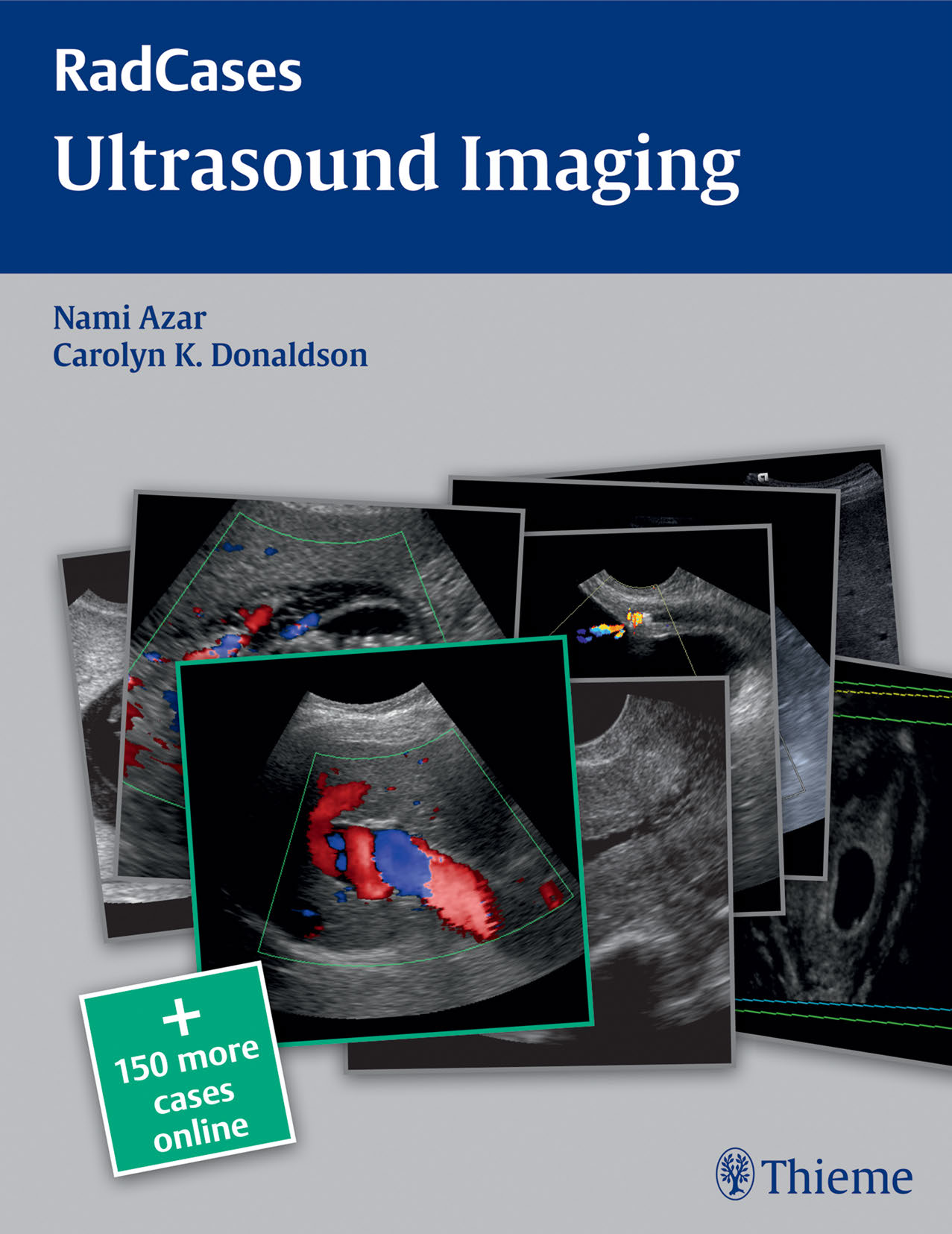 [RadCases] Azar - Ultrasound Imaging